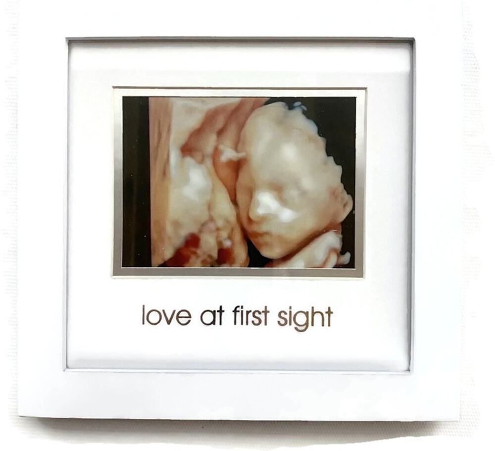 Pearhead Love at First Sight Sonogram Frame Ultrasound Nursery Decor 6.75x6.75
